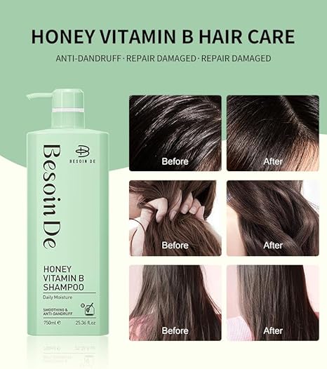 Besoin De Honey Vitamin B Shampoo and Conditioner Set, Daily Moisture, Anti-Dandruff, 25.36 fl.oz, 2-Pack